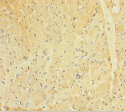 Immunohistochemistry of paraffin-embedded human heart tissue at dilution 1:100