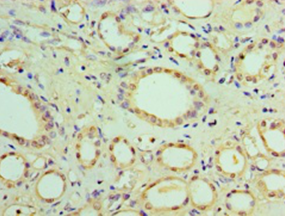 SOCS1 Polyclonal Antibody
