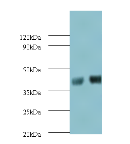 SHBG Polyclonal Antibody