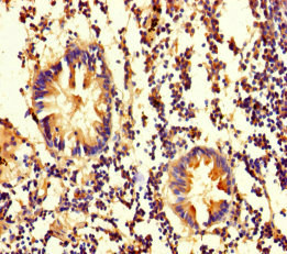 Immunohistochemistry of paraffin-embedded human appendix tissue using OLA1 Polyclonal Antibody at dilution of 1:100