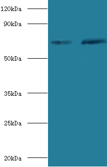 SDHA Polyclonal Antibody