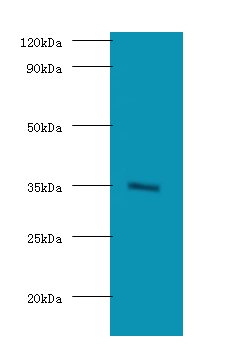 BRCC3 Polyclonal Antibody