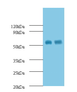 MMP12 Polyclonal Antibody