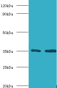 GTF2B Polyclonal Antibody