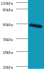 CLEC18A Polyclonal Antibody