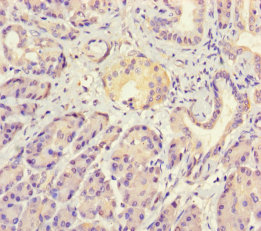 PTHLH Polyclonal Antibody