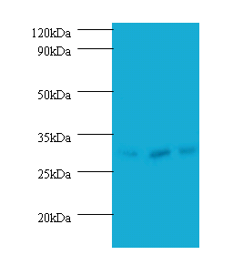 HUS1 Polyclonal Antibody