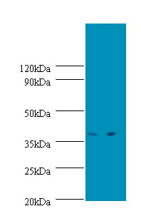 SUPT3H Polyclonal Antibody