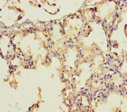 Immunohistochemistry of paraffin-embedded human brain tissue at dilution of 1:100