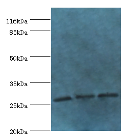 Gamt Polyclonal Antibody