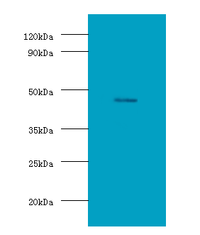 DLK1 Polyclonal Antibody