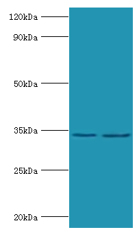 Phosphoprotein  Polyclonal Antibody