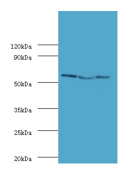 USP14 Polyclonal Antibody