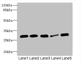 IGFBP1 Polyclonal Antibody