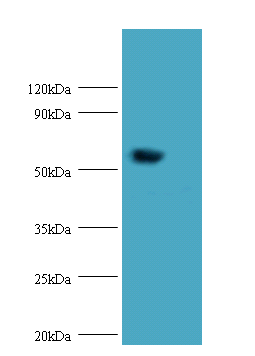 HARS2 Polyclonal Antibody