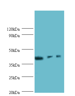 ILKAP Polyclonal Antibody