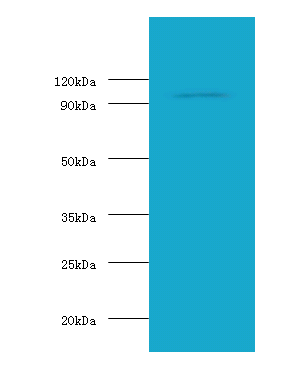 HK1 Polyclonal Antibody