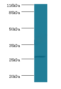TNF Polyclonal Antibody