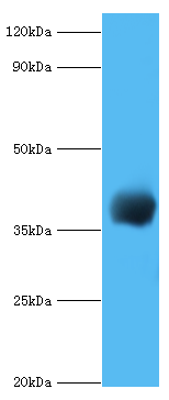 Western blot<br />All lanes: cpg2 Polyclonal Antibody at 2ug/ml+recombinant Carboxypeptidase G2 protein at 0.5ug<br />Secondary: Goat polyclonal to rabbit at 1/10000 dilution<br />Predicted band size: 38kDa <br />Observed band size: 38kDa <br />