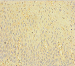 FCER1G Polyclonal Antibody