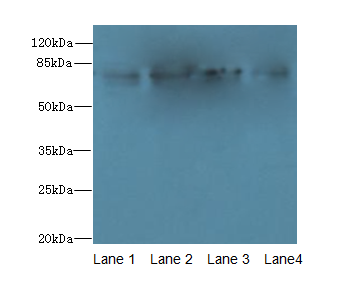 CAST Polyclonal Antibody