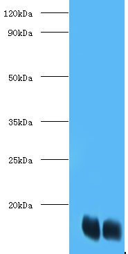 FABP1 Polyclonal Antibody
