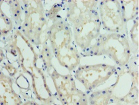 GTF2H5 Polyclonal Antibody