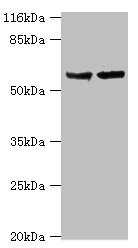 CYP17A1 Polyclonal Antibody (100 µl)