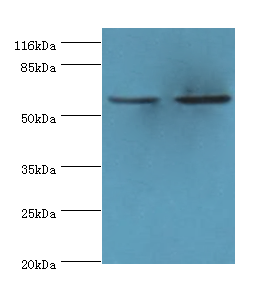 CYP17A1 Polyclonal Antibody