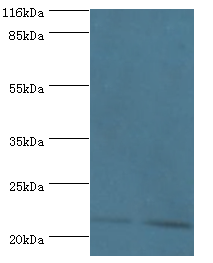 IFNA14 Polyclonal Antibody