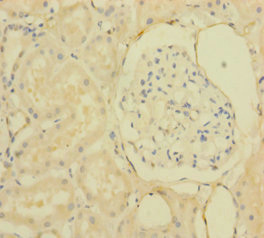 IHH Polyclonal Antibody