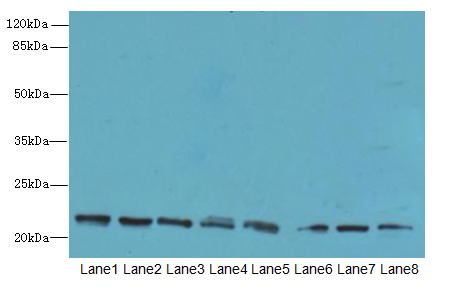 ANGPTL8 Polyclonal Antibody