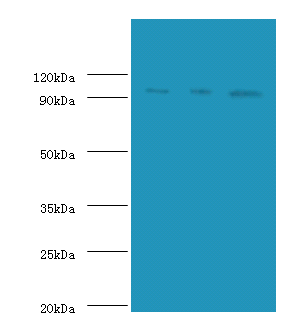 MCM2 Polyclonal Antibody