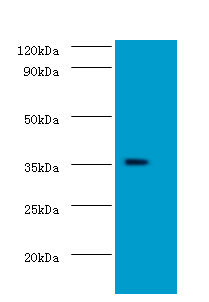 DOK5 Polyclonal Antibody