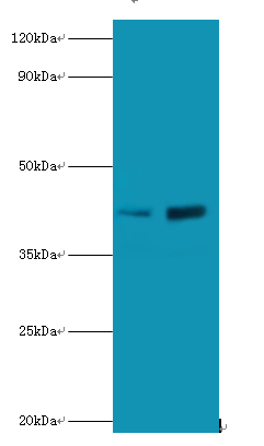 SSB Polyclonal Antibody