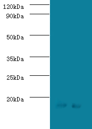 SRP19 Polyclonal Antibody