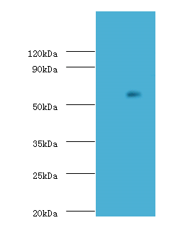 Adck2 Polyclonal Antibody