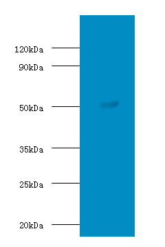 SUOX Polyclonal Antibody
