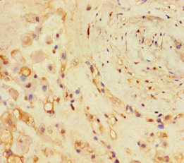 COL11A1 Polyclonal Antibody