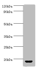 All lanes: AVP Polyclonal Antibody at 2ug/ml+rat gonad tissue<br />Secondary<br />Goat polyclonal to rabbit at 1/10000 dilution<br />Predicted band size: 17kDa<br />Observed band size: 17kDa<br />