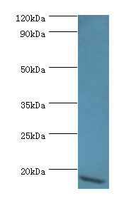 AVP Polyclonal Antibody