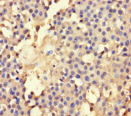 AHCY Polyclonal Antibody