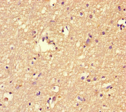 Immunohistochemistry of paraffin-embedded human brain tissue using FBXL18 Polyclonal Antibody at dilution of 1:100