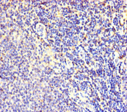 Immunohistochemistry of paraffin-embedded human lymphoid tissue using FBXL18 Polyclonal Antibody at dilution of 1:100