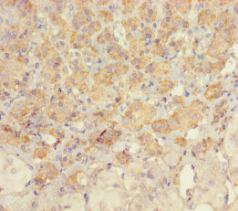 UCP1 Polyclonal Antibody