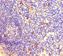 DSG3 Polyclonal Antibody