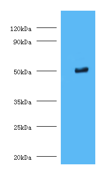TMLHE Polyclonal Antibody
