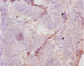 Amh Polyclonal Antibody