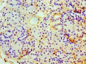 CHGA Polyclonal Antibody (50 µl)