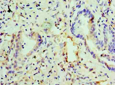 EGLN2 Polyclonal Antibody